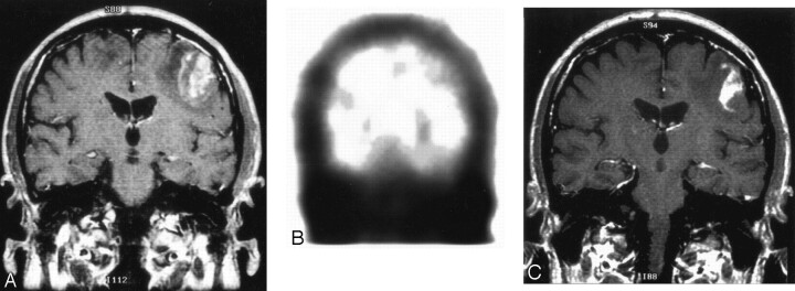 Fig 2.