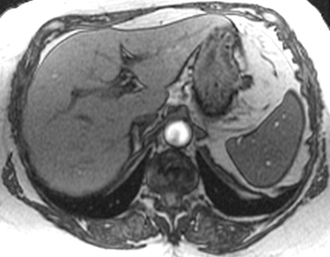 Figure 2a: