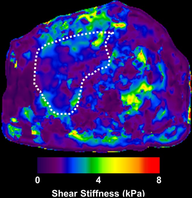 Figure 2b: