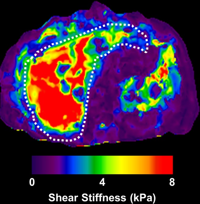 Figure 3b: