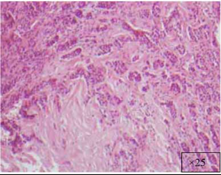 Fig. (2g)