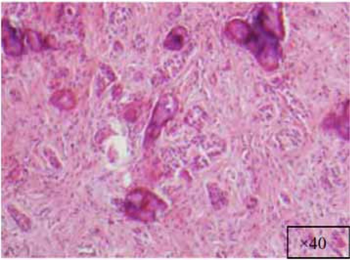 Fig. (2e)