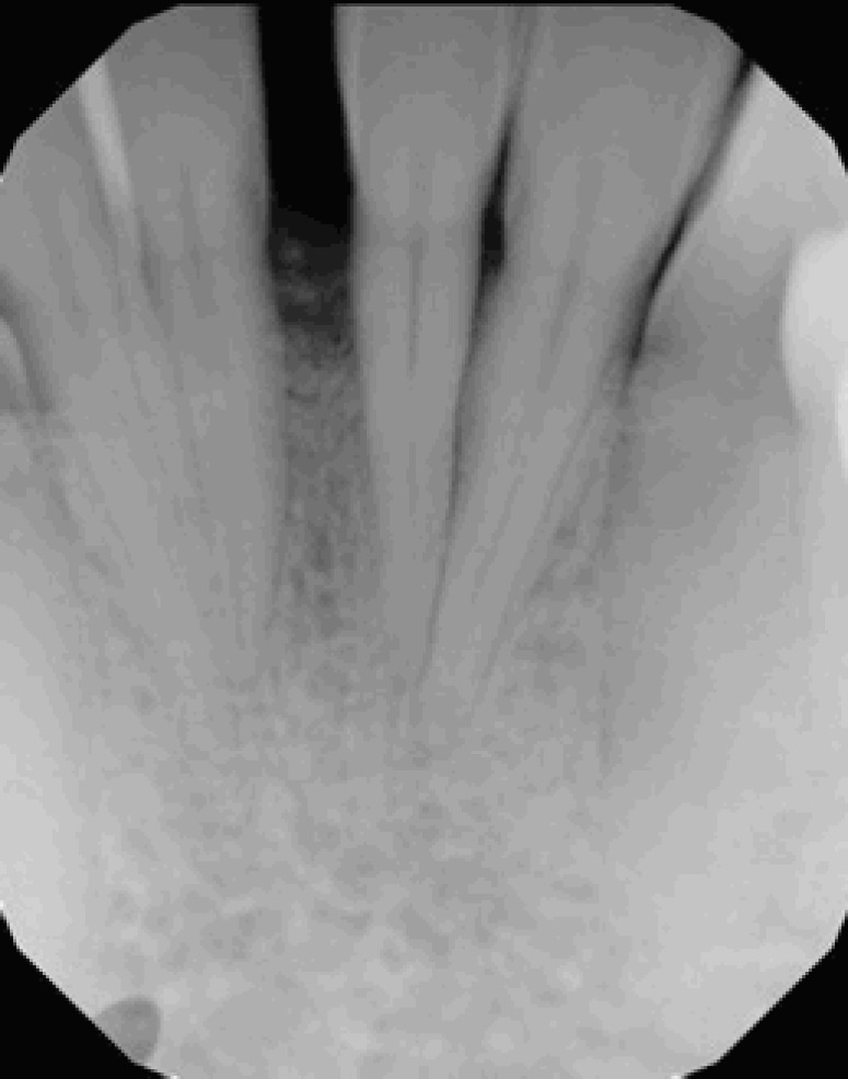 Fig. (3b)