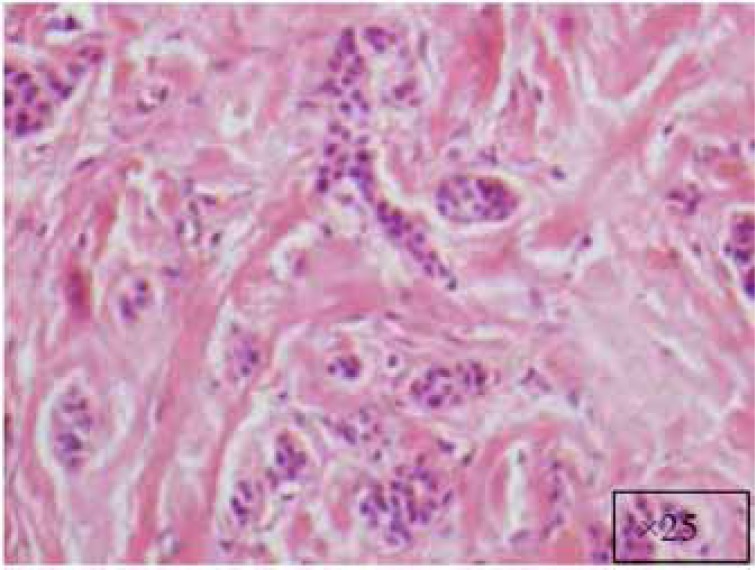 Fig. (2c)