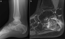 Figure 11.