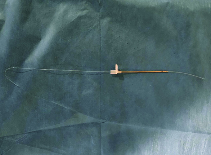 Fig. 2
