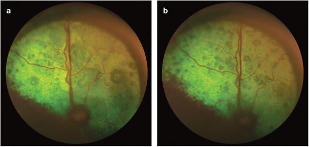 Figure 17