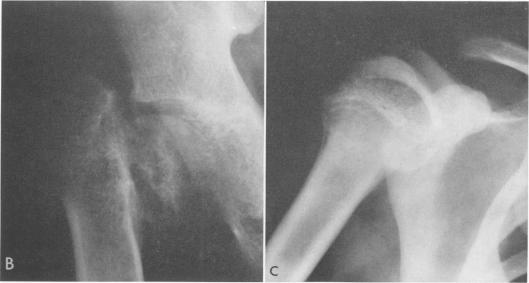 Fig. 5b., Fig. 5c.