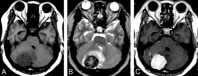 Fig 2.