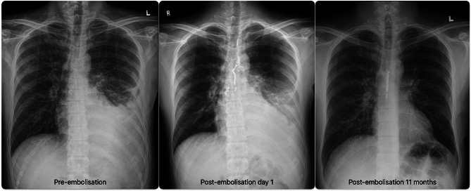 Fig. 6