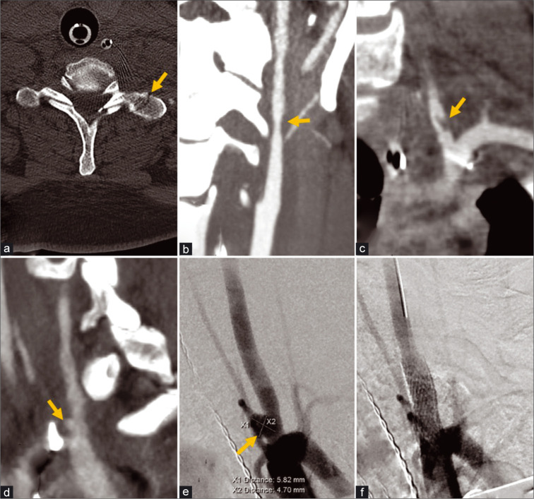 Figure 3: