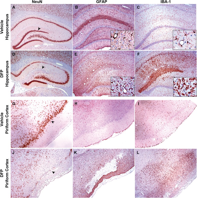 FIG. 7