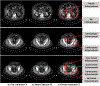 Figure 10: