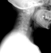 Figure 1A: