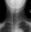 Figure 1C: