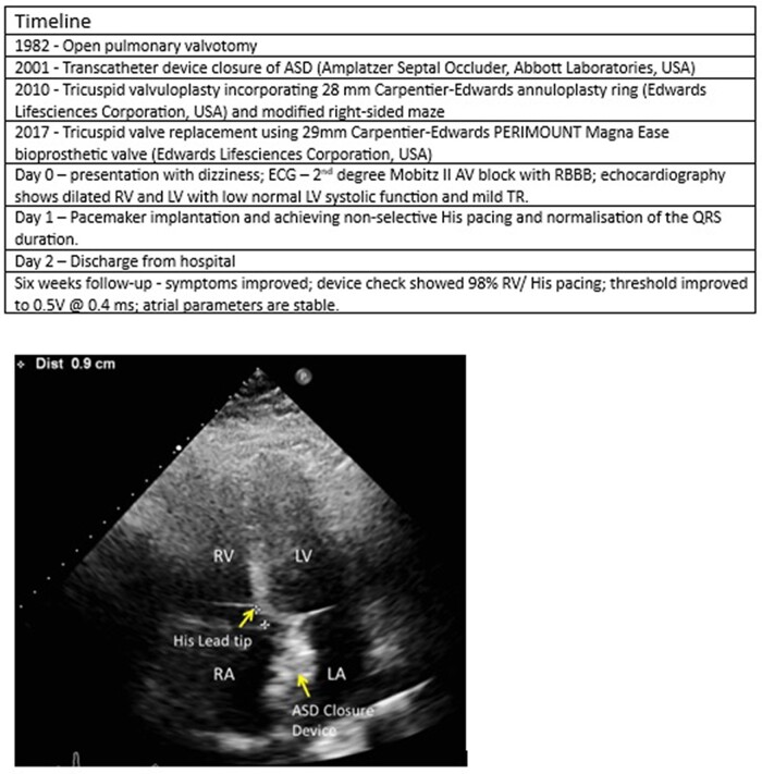 graphic file with name ytad531il2.jpg