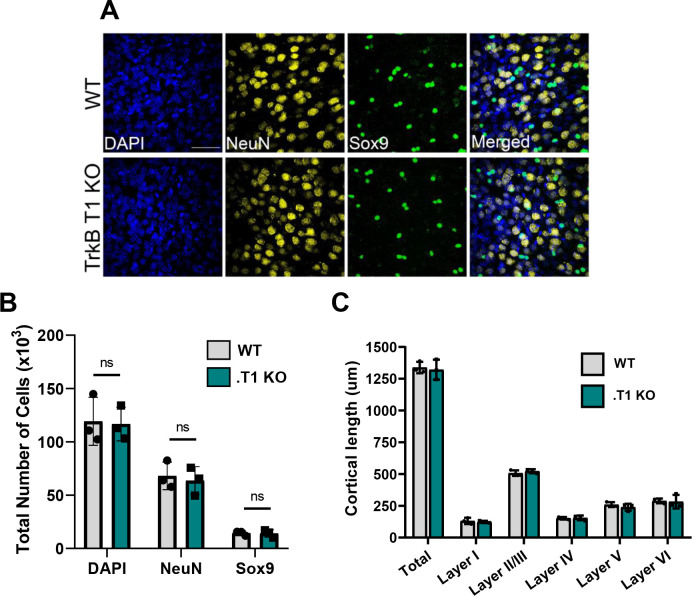 Figure 4—figure supplement 1.