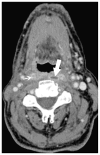 Fig. 14