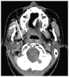 Fig. 19