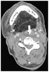 Fig. 13