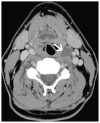 Fig. 11