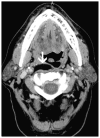 Fig. 5