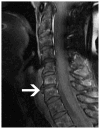 Fig. 16