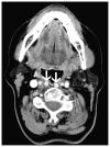 Fig. 18
