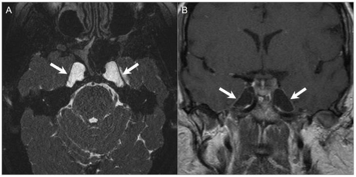 Figure 27