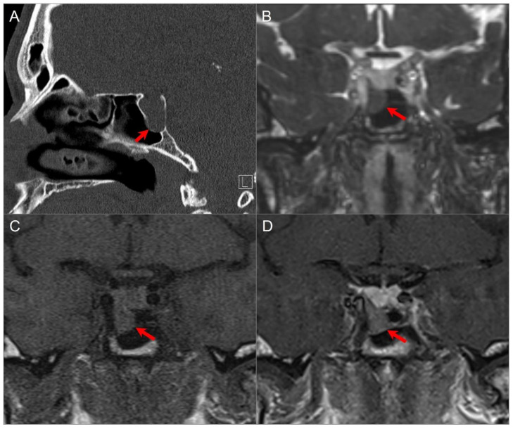 Figure 14
