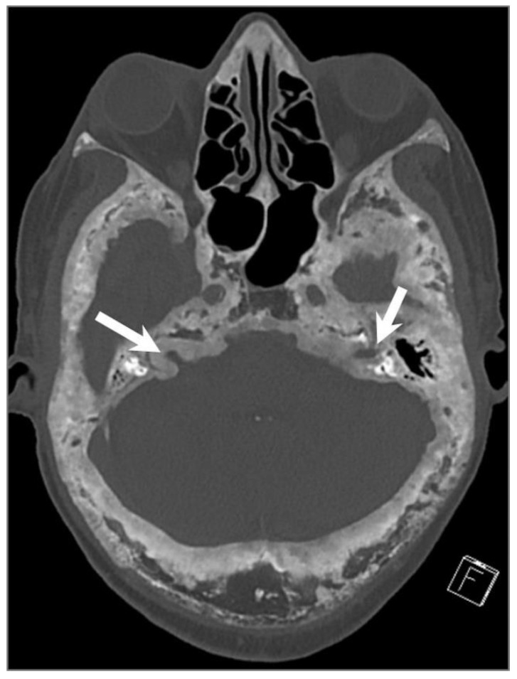 Figure 31
