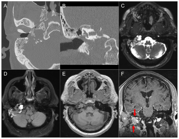 Figure 22