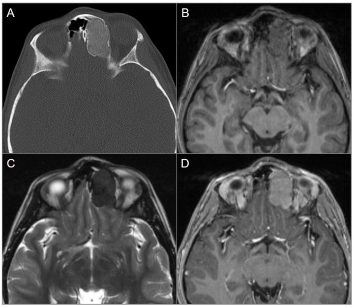 Figure 11