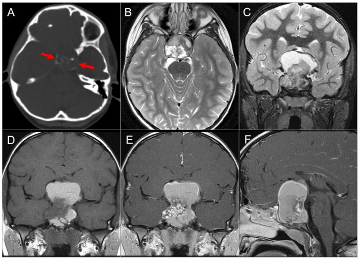 Figure 16