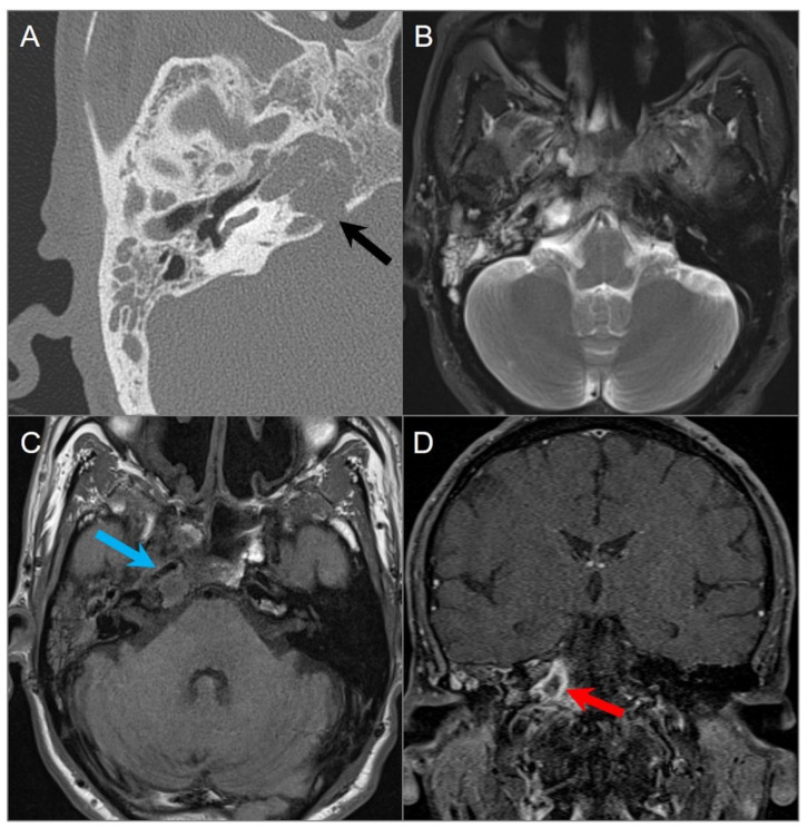 Figure 30