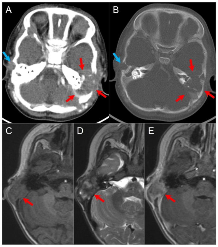 Figure 17