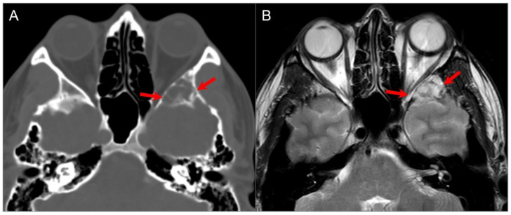 Figure 25