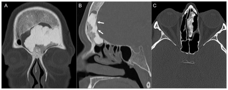 Figure 12