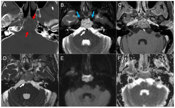 Figure 19