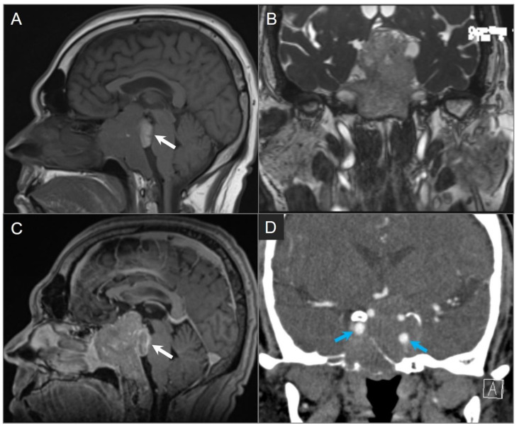 Figure 15