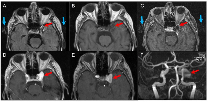 Figure 33