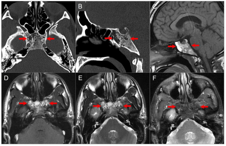 Figure 24