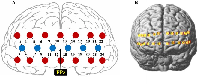 FIGURE 1