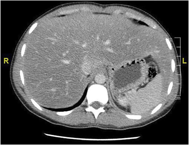 FIGURE 3