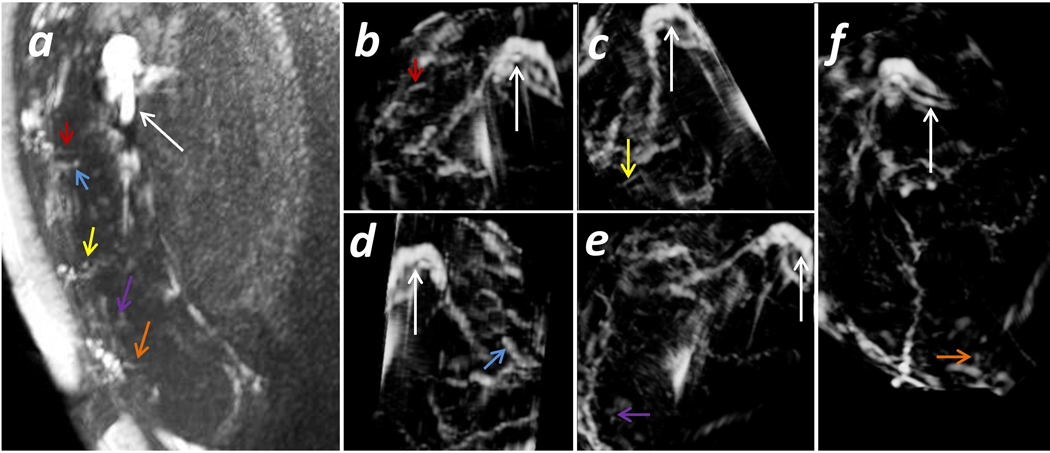 Fig 3.