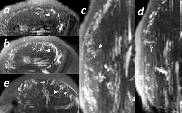 Fig 4.