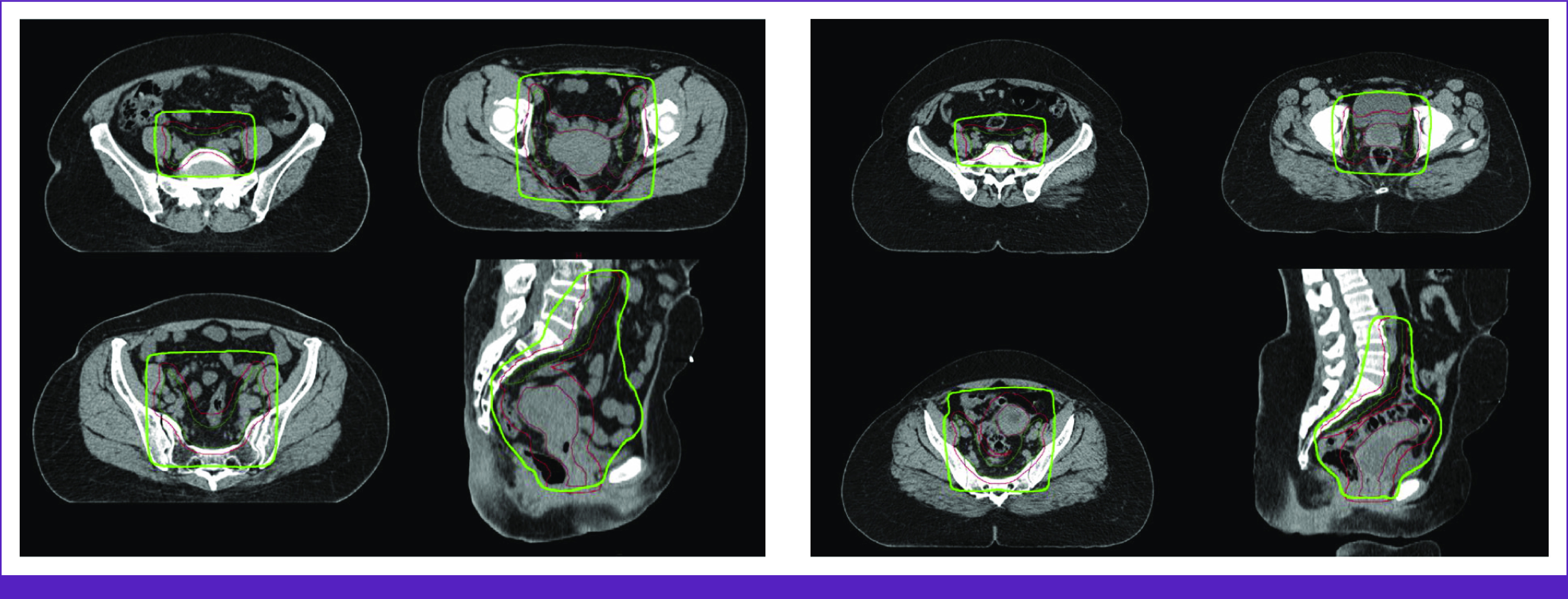 FIG 2