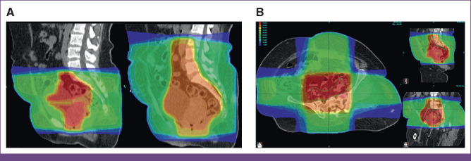 FIG 3