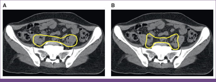 FIG 1