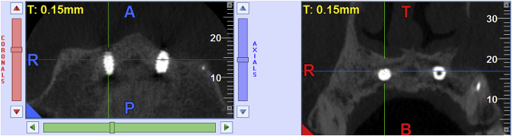 Fig. 14